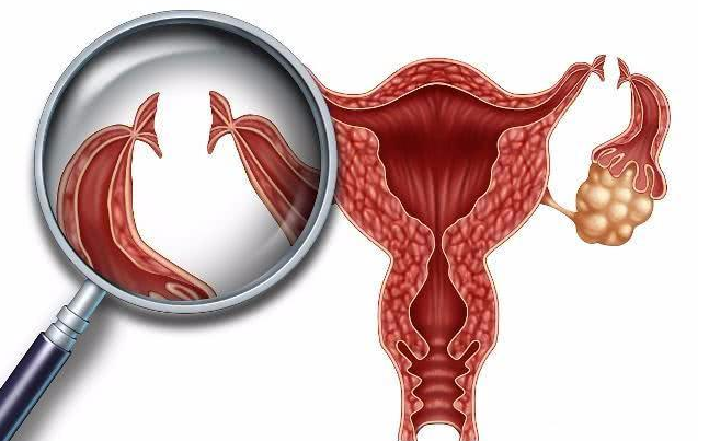 生娃后結扎好還是上環好 生完孩子什么時候避孕