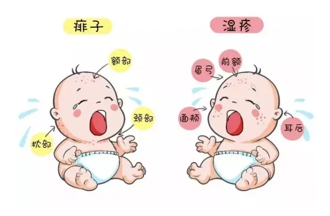 區分痱子和濕疹的方法是什么 怎么知道孩子得的是痱子