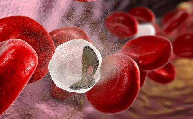 怎么判斷寶寶是不是貧血 如何預(yù)防寶寶貧血