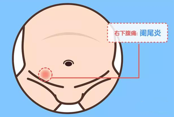 怎么用手指判斷孩子肚子痛 孩子肚子痛要去醫院嗎