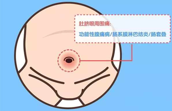 怎么用手指判斷孩子肚子痛 孩子肚子痛要去醫院嗎