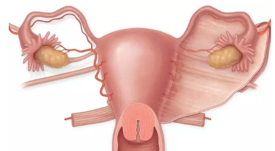 子宮切除還能有性生活嗎 子宮切除對(duì)性生活影響大嗎