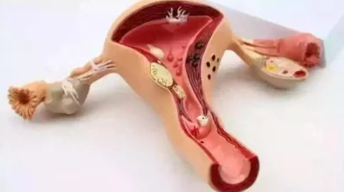 女性一般什么情況下切除子宮 子宮切除后要怎么保養