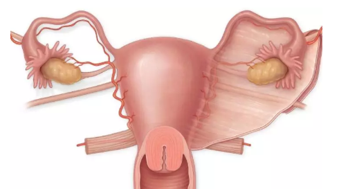 女性一般什么情況下切除子宮 子宮切除后要怎么保養