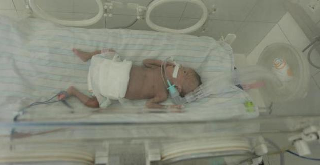 巴掌寶寶小清媱出院 河南巴掌寶寶最新消息