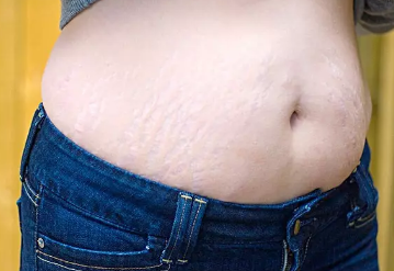 孕婦濕氣重會影響胎兒嗎 孕婦濕氣重吃什么好 孕婦濕氣重會影響胎兒嗎 孕婦濕氣重吃什么好