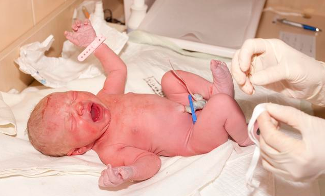 寶寶臍帶里有黏液正常嗎 寶寶臍帶里有黏液是怎么回事 寶寶臍帶里有黏液正常嗎 寶寶臍帶里有黏液是怎么回事