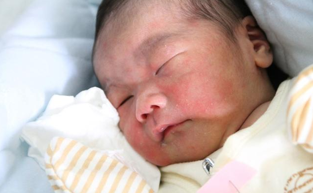 寶寶長痱子可以用爽身粉嗎 寶寶長痱子如何防治