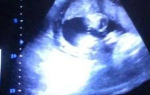 2019年6月7受孕生男生女 農歷五月初五懷孕是男孩還是女孩