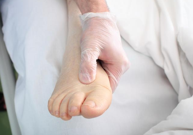 孕婦如何區(qū)分水腫和肥胖 緩解孕期水腫的方法 孕婦如何區(qū)分水腫和肥胖 緩解孕期水腫的方法