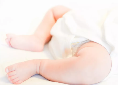 紙尿褲用久了會變成羅圈腿嗎 寶寶紙尿褲的正確穿法