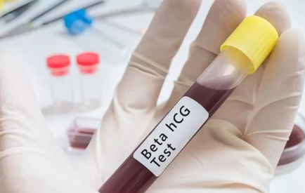 抽血測孕酮和HCG能看懷孕嗎 準確檢查懷孕的方法有哪些