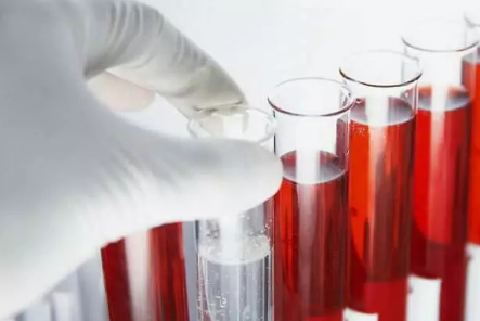 孕酮下降HCG翻倍不好怎么回事 孕酮下降HCG翻倍不好是流產(chǎn)嗎 孕酮下降HCG翻倍不好怎么回事 孕酮下降HCG翻倍不好是流產(chǎn)嗎