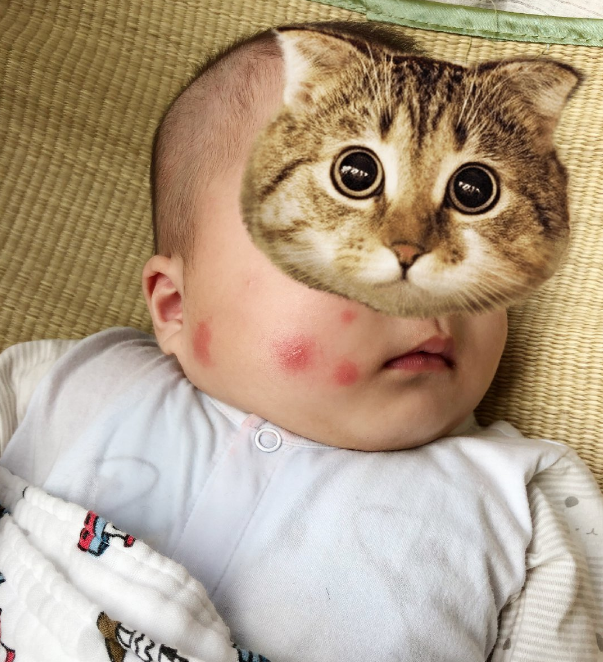 被蚊子咬了的心情句子 蚊子半夜咬醒說說朋友圈