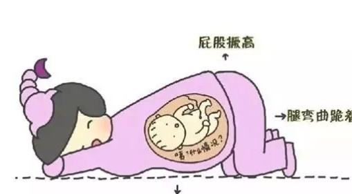 胎位糾正的最佳時間是第幾周 胎位糾正枕前位是最佳胎位