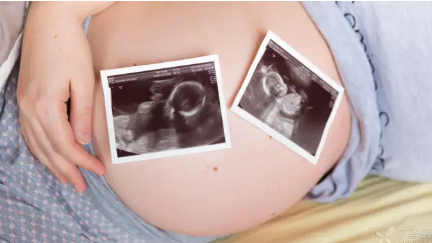 懷雙胞胎吃葉酸要加量嗎 懷雙胞胎吃葉酸要吃兩片嗎