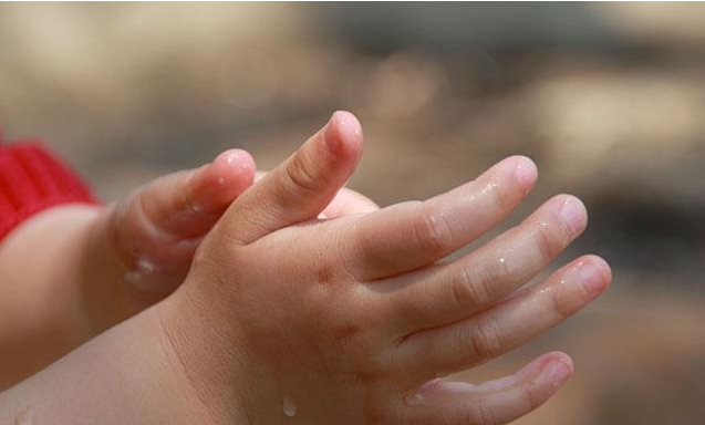 孩子燙傷抹牙膏有用嗎 孩子被燙傷處理的正確方法