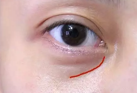 孕婦脾胃虛濕氣重會影響奶水嗎 孕婦脾胃虛怎么辦