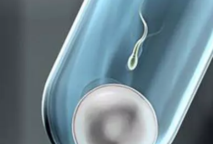 輸卵管通而不暢促排可以嗎 輸卵管通而不暢做什么運(yùn)動比較好