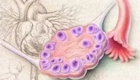 卵巢多囊樣改變會影響懷孕嗎 多囊卵巢綜合癥好懷孕嗎 卵巢多囊樣改變會影響懷孕嗎 多囊卵巢綜合癥好懷孕嗎