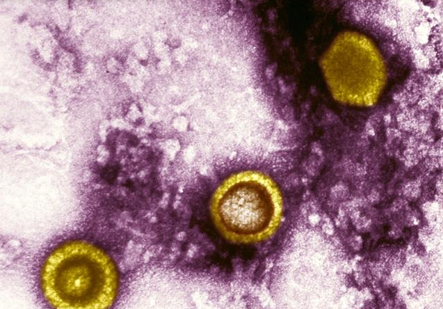 女性患生殖器皰疹的癥狀 女性患有生殖器皰疹有哪些危害 女性患生殖器皰疹的癥狀 女性患有生殖器皰疹有哪些危害