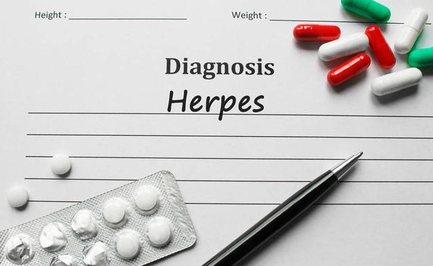 帶狀皰疹和生殖器皰疹一樣嗎 生殖器皰疹和帶狀皰疹有什么區別