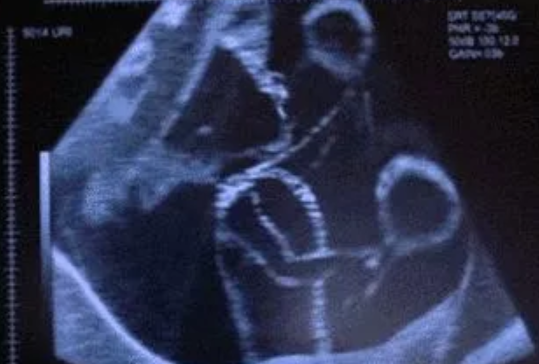 需要在固定的時(shí)間數(shù)胎動(dòng)嗎 懷孕數(shù)胎動(dòng)時(shí)間早上還是晚上