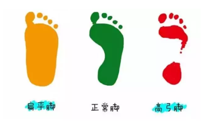 學(xué)步鞋為什么不能穿舊的 孩子不能穿二手鞋的原因