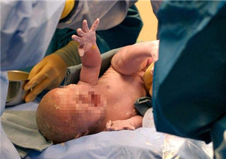 羊水栓塞是什么原因引起的 發生羊水栓塞前的征兆