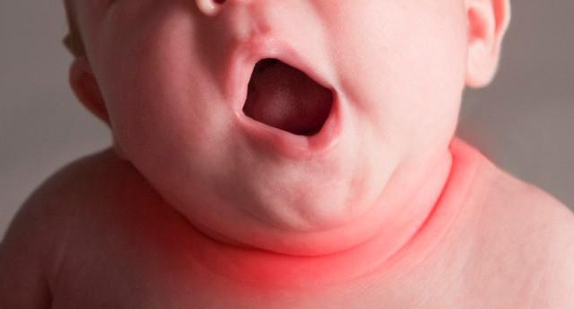 寶淹脖子發紅怎么護理 如何避免淹脖子復發 寶淹脖子發紅怎么護理 如何避免淹脖子復發