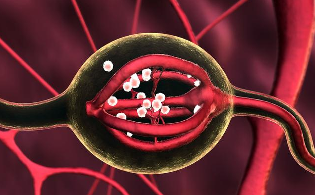 輸卵管上舉跳繩有用嗎 輸卵管上舉怎么治療