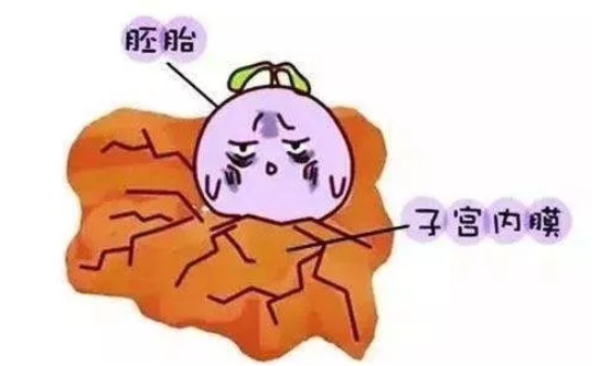 子宮內(nèi)膜太薄是卵巢早衰嗎 導(dǎo)致子宮內(nèi)膜變薄的原因有哪些 子宮內(nèi)膜太薄是卵巢早衰嗎 導(dǎo)致子宮內(nèi)膜變薄的原因有哪些