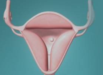 子宮內膜太厚會怎么樣 子宮內膜厚度不正常怎么辦