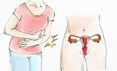 子宮位置異常怎么回事 子宮位置異常怎么確診
