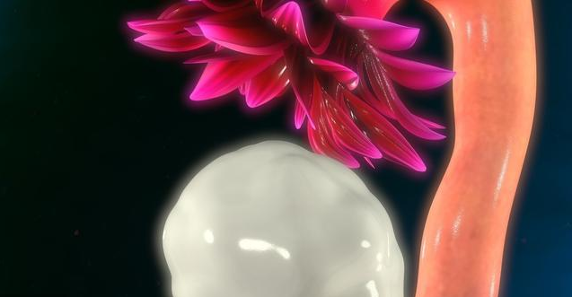 多囊卵巢會影響懷孕嗎 多囊患者可以做試管嬰兒嗎 多囊卵巢會影響懷孕嗎 多囊患者可以做試管嬰兒嗎