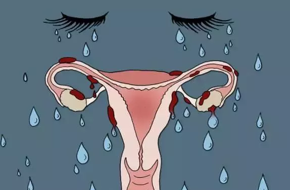 子宮發(fā)育不良能治愈嗎 子宮發(fā)育不良不來月經(jīng)怎么辦