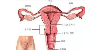 子宮內膜炎嚴重嗎 子宮內膜炎嚴重后果癥狀 子宮內膜炎嚴重嗎 子宮內膜炎嚴重后果癥狀