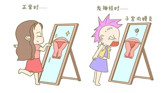 子宮內(nèi)膜炎吃什么藥好 子宮內(nèi)膜炎用什么方法治療