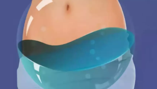 盆腔積液懷孕后會出血嗎 盆腔積液影響懷孕嗎