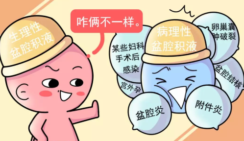 盆腔積液還能懷孕嗎 盆腔積液懷孕幾率大嗎 盆腔積液還能懷孕嗎 盆腔積液懷孕幾率大嗎