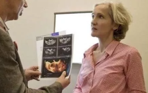 盆腔積液治療效果不明顯原因 B超檢查有少量盆腔積液嚴重嗎