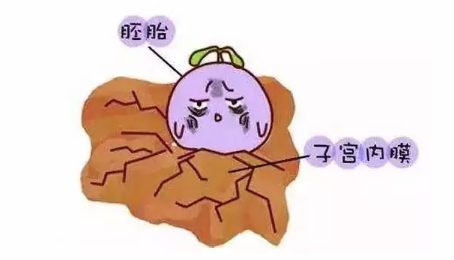 急性子宮內(nèi)膜炎的發(fā)病原因 急性子宮內(nèi)膜炎嚴重嗎