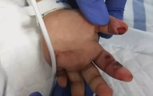 1歲女童被摔死怎么回事 1歲女童被母親男友摔死原因