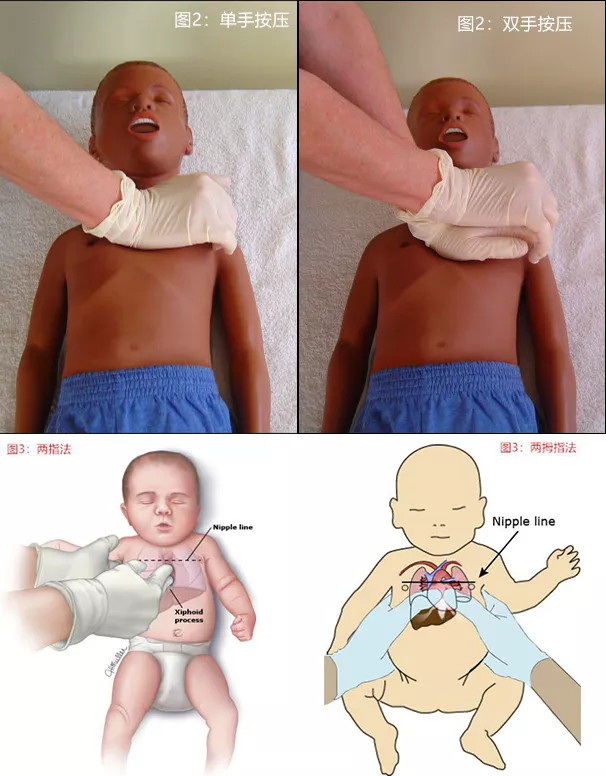 孩子溺水后怎么急救 孩子溺水后正確急救方法