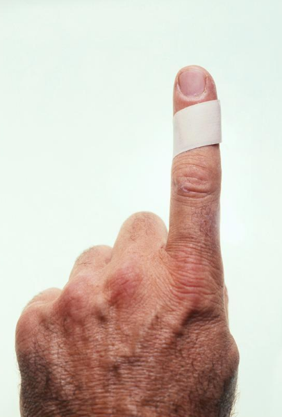 創可貼是什么垃圾 創可貼是干垃圾還是濕垃圾