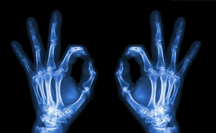 x光片是什么垃圾 x光片是干垃圾嗎