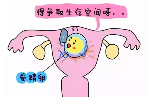 宮腔粘連會導(dǎo)致不孕嗎 宮腔粘連主要臨床表現(xiàn)