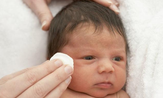 寶寶眼屎又多又黃是上火了嗎 清理眼屎的四大步驟 寶寶眼屎又多又黃是上火了嗎 清理眼屎的四大步驟