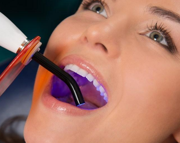 備孕期間拔智齒可以嗎 備孕期間拔智齒有影響嗎