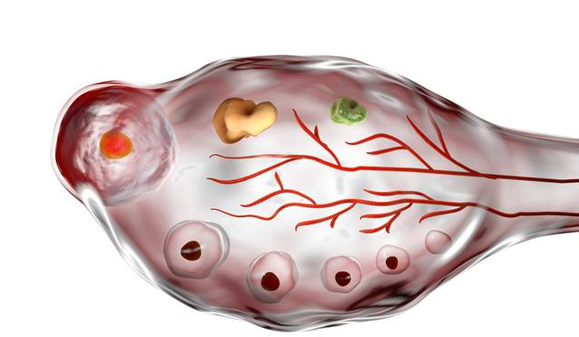 多囊促排懷孕一定要保胎嗎 多囊懷孕了怎么保胎